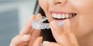 Invisalign